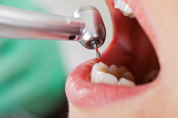 Best Emergency Treatment for Toothache in Ina, IL